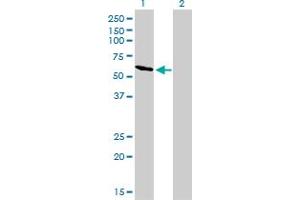 Western Blotting (WB) image for anti-RRIO Kinase 3 (RIOK3) (AA 411-516) antibody (ABIN563784)
