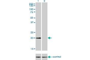 Western blot analysis of CSRP3 over-expressed 293 cell line, cotransfected with CSRP3 Validated Chimera RNAi (Lane 2) or non-transfected control (Lane 1). (CSRP3 抗体  (AA 95-194))