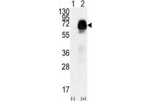 Western Blotting (WB) image for anti-Anti-Mullerian Hormone Receptor, Type II (AMHR2) antibody (ABIN3002999) (AMHR2 抗体)