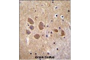 Immunohistochemistry (Paraffin-embedded Sections) (IHC (p)) image for anti-Adaptor-Related Protein Complex 1, mu 1 Subunit (AP1M1) (AA 199-227) antibody (ABIN655975)