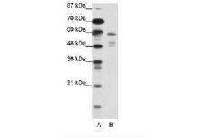 Image no. 1 for anti-Nuclear Receptor Subfamily 1, Group H, Member 3 (NR1H3) (N-Term) antibody (ABIN202546) (NR1H3 抗体  (N-Term))
