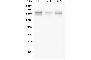 Western blot analysis of GLI2 using anti-GLI2 antibody (ABIN6719569). (GLI2 抗体  (AA 721-1457))