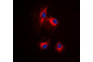Immunofluorescent analysis of MRPL15 staining in HuvEc cells. (MRPL15 抗体  (Center))