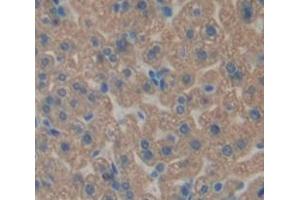 IHC-P analysis of Mouse Tissue, with DAB staining. (HSD17B10 抗体  (AA 4-202))
