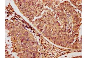 Immunohistochemistry (IHC) image for anti-RAC1 (AA 11-185) antibody (ABIN7167196)