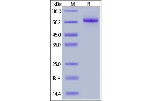 Human IL-12 R beta 1, His Tag on  under reducing (R) condition. (IL12RB1 Protein (AA 24-540) (His tag))