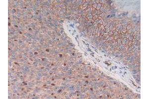 Figure. (S100A14 抗体  (AA 1-91))