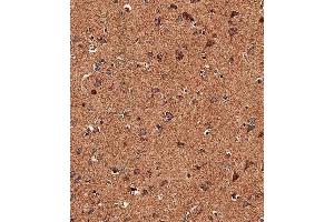 Immunohistochemistry (Paraffin-embedded Sections) (IHC (p)) image for anti-Transient Receptor Potential Cation Channel, Subfamily V, Member 1 (TRPV1) (AA 124-153), (N-Term) antibody (ABIN657909)