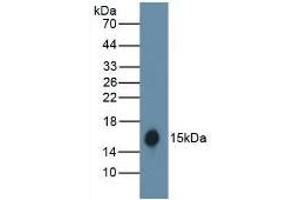 Detection of recombinant HB using Polyclonal Antibody to Hemoglobin (HB) (Hemoglobin 抗体)