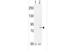 Western blot analysis of FGFR1 (arrow) using rabbit polyclonal FGFR1- (ABIN653771 and ABIN2843063). (FGFR1 抗体  (AA 285-314))