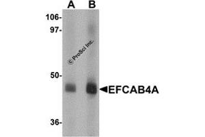 Western Blotting (WB) image for anti-EF-Hand Calcium Binding Domain 4A (EFCAB4A) (Middle Region) antibody (ABIN1030922) (EFCAB4A 抗体  (Middle Region))