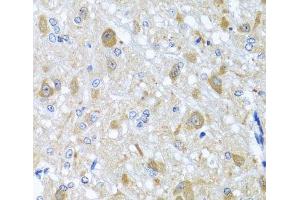 Immunohistochemistry of paraffin-embedded Rat brain using BNIP3L Polyclonal Antibody at dilution of 1:100 (40x lens). (BNIP3L/NIX 抗体)