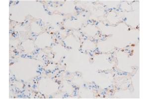 ABIN6267603 at 1/200 staining Rat lung tissue sections by IHC-P. (PKC theta 抗体  (pSer676))
