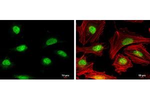 ICC/IF Image Rad51 antibody [N1C2] detects Rad51 protein at nucleus by immunofluorescent analysis. (RAD51 抗体  (Center))