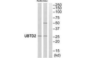 Western blot analysis of extracts from HuvEc cells and COLO cells, using UBTD2 antibody. (UBTD2 抗体  (C-Term))