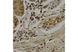 Immunohistochemistry of paraffin-embedded human normal stomach using UMPS antibody at dilution of 1:200 (400x lens). (UMPS 抗体)