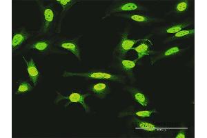 Immunofluorescence of purified MaxPab antibody to KIAA1967 on HeLa cell. (CCAR2 抗体  (AA 1-923))