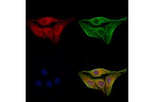 ABIN6264259 and ABIN6273065 staining Hela cells by IF/ICC. (PKLR 抗体  (Internal Region))