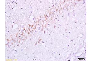Formalin-fixed and paraffin embedded rat brain tissue labeled with Anti BETA(TYR1345) Polyclonal Antibody,Unconjugated (ABIN747128) at 1:200 followed by conjugation to the secondary antibody and DAB staining. (ISR-beta 抗体  (pTyr1355))