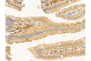 ABIN7094769 and ABIN7098820 at 1/100 staining Mouse stomach tissue by IHC-P. (PRMT3 抗体  (Internal Region))