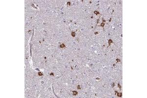 Immunohistochemical staining (Formalin-fixed paraffin-embedded sections) of human cerebral cortex with FMR1 polyclonal antibody  shows strong cytoplasmic positivity in neuronal cells at 1:200 - 1:500 dilution. (FMR1 抗体)