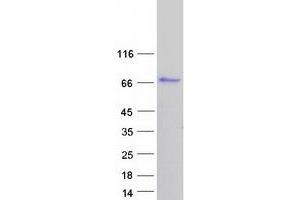 Western Blotting (WB) image for Calpastatin (CAST) (Transcript Variant 3) protein (Myc-DYKDDDDK Tag) (ABIN2713067)