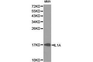 Western Blotting (WB) image for anti-Interleukin 1 alpha (IL1A) antibody (ABIN1873200) (IL1A 抗体)