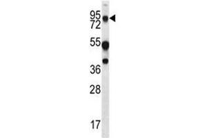 MUC20 antibody western blot analysis in WiDr lysate. (MUC20 抗体  (AA 654-684))