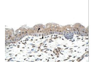 RNF25 antibody was used for immunohistochemistry at a concentration of 4-8 ug/ml. (RNF25 抗体  (Middle Region))
