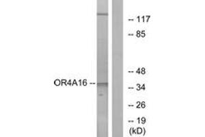 Western blot analysis of extracts from COLO cells, using OR4A16 Antibody. (OR4A16 抗体  (AA 261-310))