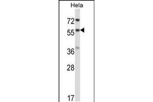 Western blot analysis in Hela cell line lysates (35ug/lane). (RANGAP1 抗体  (N-Term))