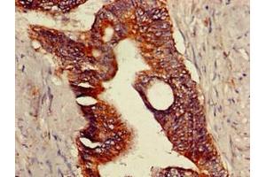 Immunohistochemistry (IHC) image for anti-Transient Receptor Potential Cation Channel, Subfamily V, Member 1 (TRPV1) (AA 1-155) antibody (ABIN7172875)