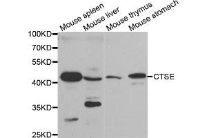 Western blot analysis of extracts of various cell lines, using CTSE antibody. (Cathepsin E 抗体)
