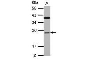 Image no. 2 for anti-B-Cell CLL/lymphoma 7C (BCL7C) (AA 1-215) antibody (ABIN1496855) (BCL7C 抗体  (AA 1-215))