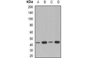 Western blot analysis of ACAA1 expression in A549 (A), Jurkat (B), mouse kidney (C), rat liver (D) whole cell lysates. (ACAA1 抗体)