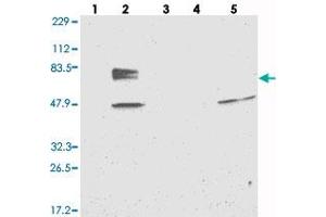 Western blot analysis of Lane 1: RT-4, Lane 2: U-251 MG, Lane 3: Human Plasma, Lane 4: Liver, Lane 5: Tonsil with EYA4 polyclonal antibody . (EYA4 抗体)