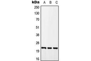 Western blot analysis of CALY expression in A549 (A), Raw264. (CALY 抗体  (Center))