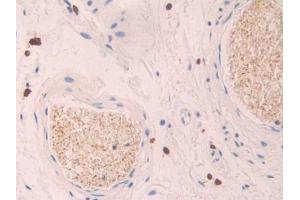 Immunohistochemistry (IHC) image for anti-Platelet Factor 4 (PF4) (AA 31-101) antibody (ABIN7431254)