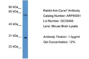 WB Suggested Anti-Cpne7  Antibody Titration: 0. (CPNE7 抗体  (C-Term))