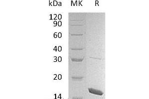 Western Blotting (WB) image for Interleukin 1 eta (FIL1h) protein (ABIN7320596) (FIL1h 蛋白)