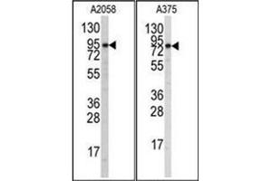 Western blot analysis of anti-Autophagy ATG9A Antibody (C-term) in A2058 and A375 cell line lysates (35ug/lane). (ATG9A 抗体  (C-Term))