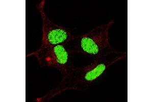 Fluorescent confocal image of SY5Y cells stained with phospho- LIN28-  antibody. (LIN28A 抗体  (pSer134))
