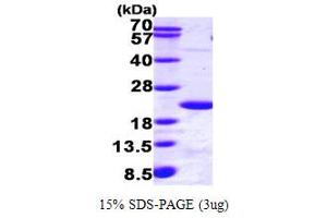 Ubiquitin-Conjugating Enzyme E2B (UBE2B) (AA 1-152) protein (His tag)