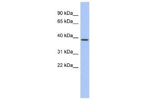 WB Suggested Anti-EN1 Antibody Titration:  0. (EN1 抗体  (Middle Region))