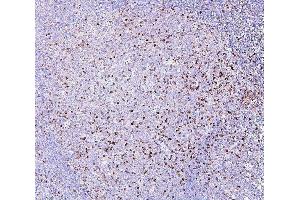IHC analysis of RAB27A using anti-RAB27A antibody (ABIN7602714).