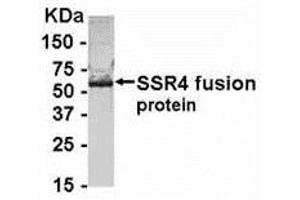Western Blotting (WB) image for anti-Signal Sequence Receptor, delta (SSR4) (AA 61-130) antibody (ABIN2468174) (SSR4 抗体  (AA 61-130))