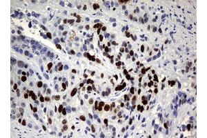 Image no. 3 for anti-Antigen Identified By Monoclonal Antibody Ki-67 (MKI67) (AA 1160-1493) antibody (ABIN1490857) (Ki-67 抗体  (AA 1160-1493))