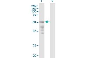 Lane 1: CXCR4 transfected lysate ( 39. (CXCR4 293T Cell Transient Overexpression Lysate(Denatured))