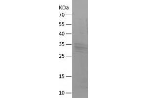 Western Blotting (WB) image for Brain Natriuretic Peptide (BNP) (AA 27-121) protein (His-IF2DI Tag) (ABIN7122022)