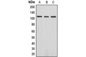 Western blot analysis of PSD93 expression in Jurkat (A), SHSY5Y (B), HepG2 (C) whole cell lysates. (DLG2 抗体  (Center))